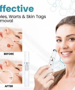 Hidone® 2-In-1 Non-Invasive Laser Pen