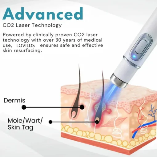 Hidone® 2-In-1 Non-Invasive Laser Pen